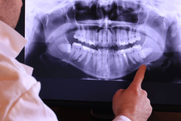 Best Emergency Dentist for Lost Fillings or Crowns in Southside, AR