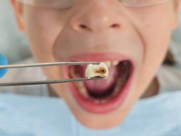 Best Mobile Emergency Dentist in Southside, AR